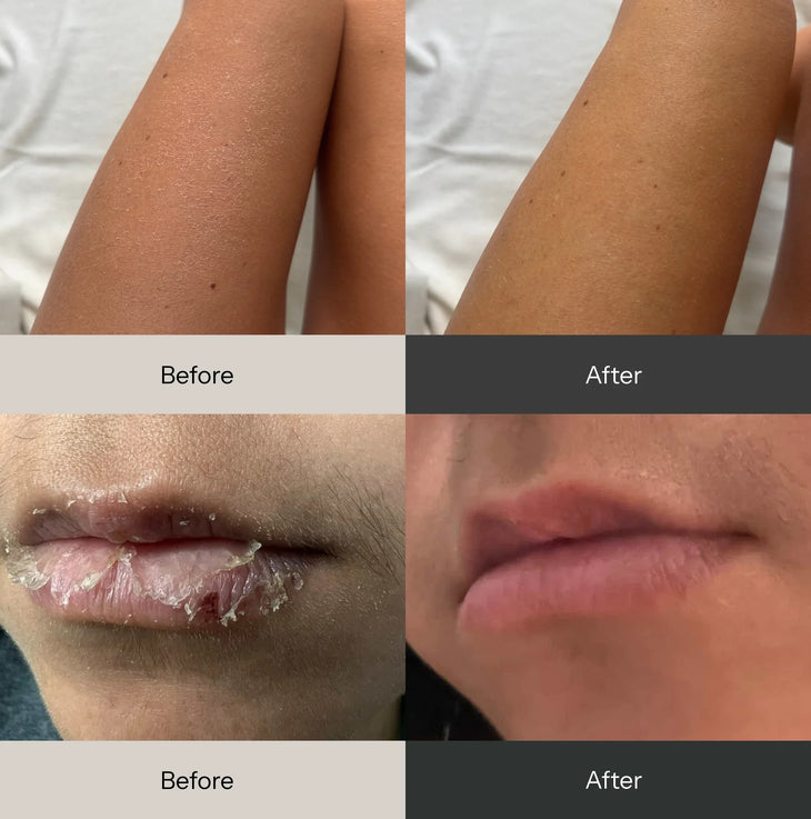Before and after comparison showing smoother skin on legs and clearer, more moisturized lips — Balm Space | Endless UAE